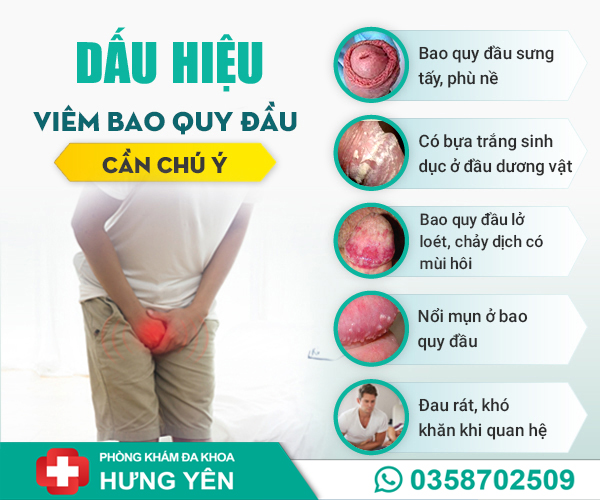 Dấu hiệu viêm bao quy đầu ở nam giới