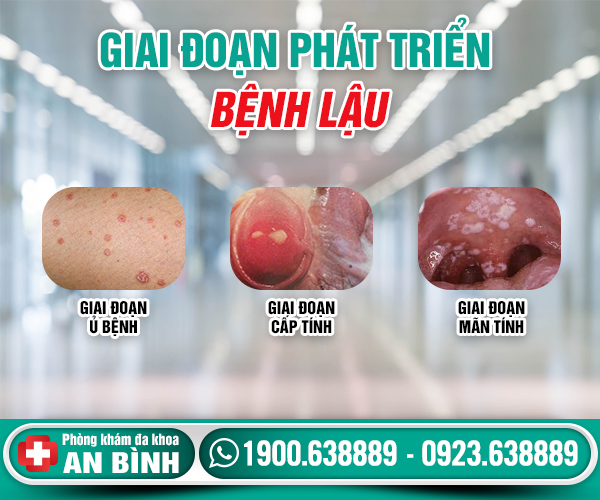 giai-doan-phat-trien-benh-lau