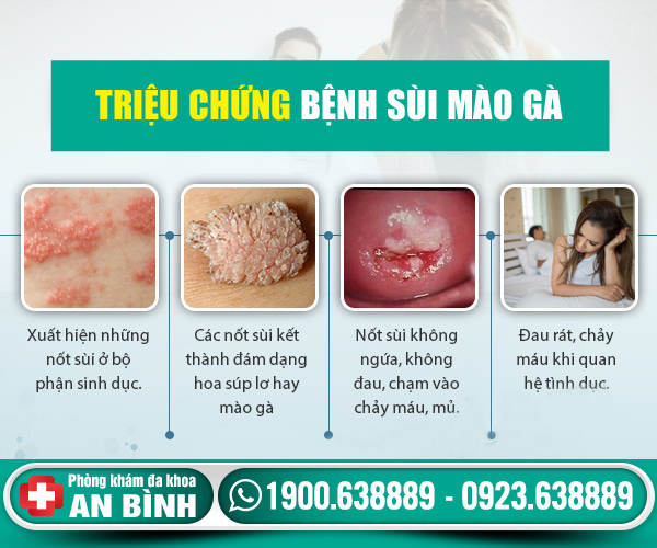 Triệu chứng sùi mào gà