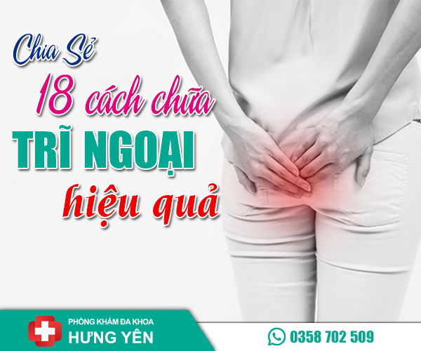 Cách chữa bệnh trĩ ngoại