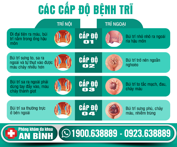 cac cap do benh tri
