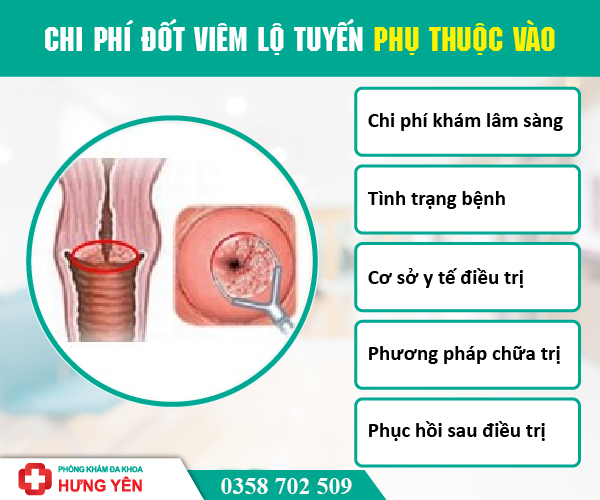 Chi phí điều trị viêm lộ tuyến cổ tử cung