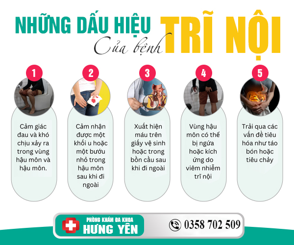 Dấu hiệu của bệnh trĩ nội