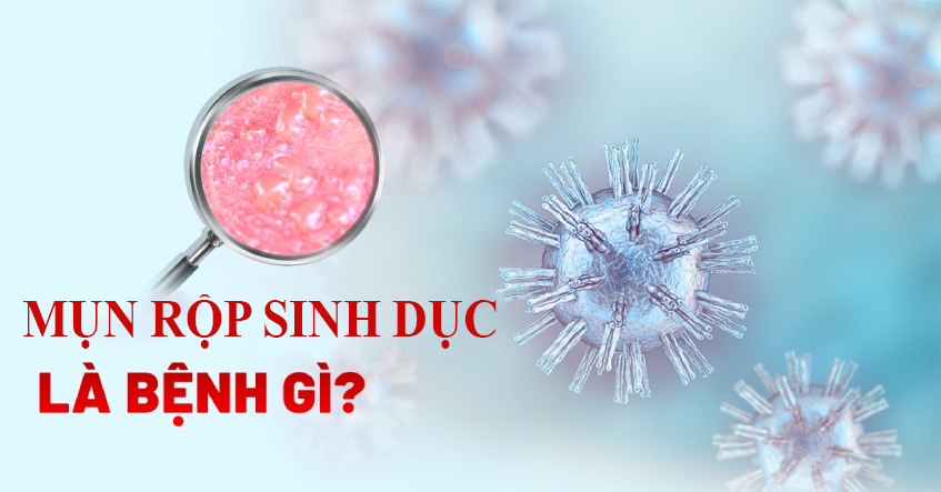 Mụn rộp sinh dục: hình ảnh, dấu hiệu nhận biết & cách chữa trị