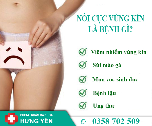 Nổi cục ở vùng kín là bệnh lý nguy hiểm nào? Cách chữa hiệu quả thế nào?