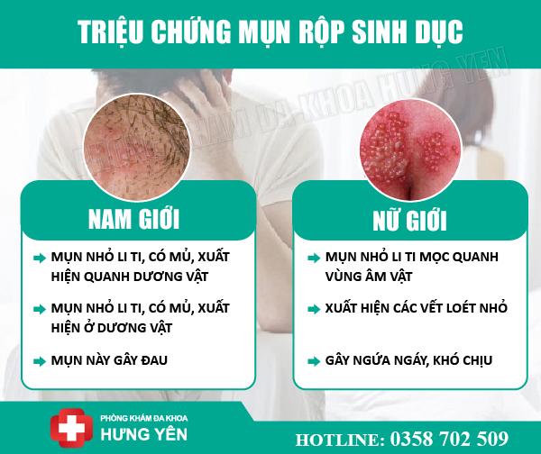 Dấu hiệu của mụn rộp sinh dục 