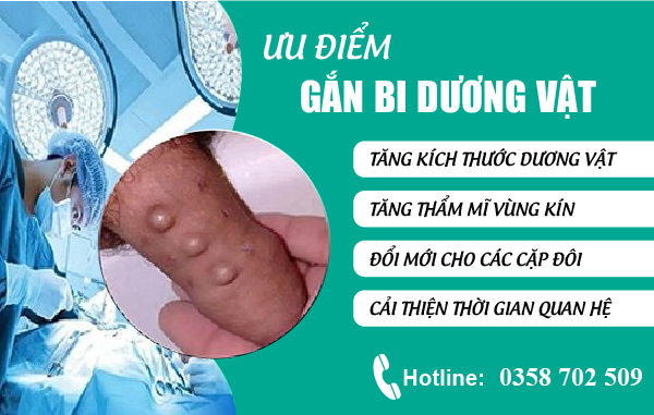 Lợi ích của gắn bi dương vật