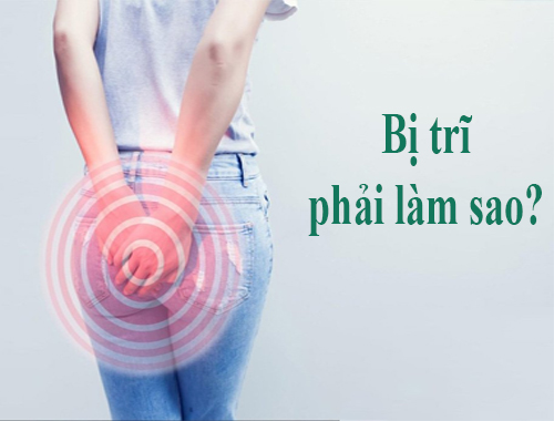 Bị Trĩ Phải Làm Sao?