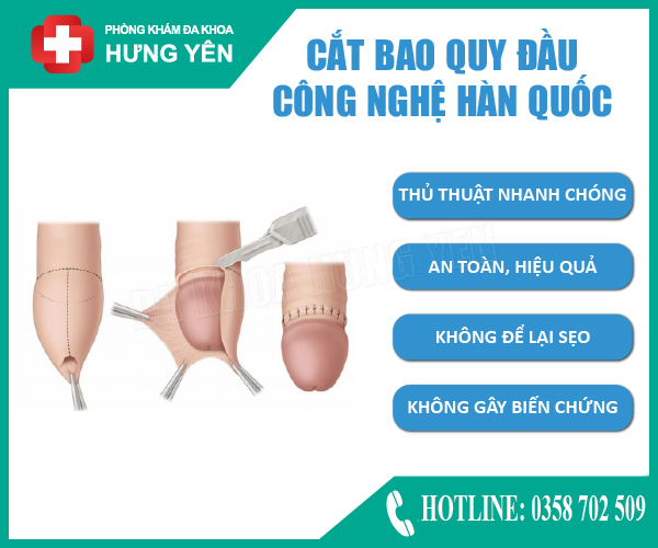 Dài Bao Quy Đầu Phải Làm Sao?