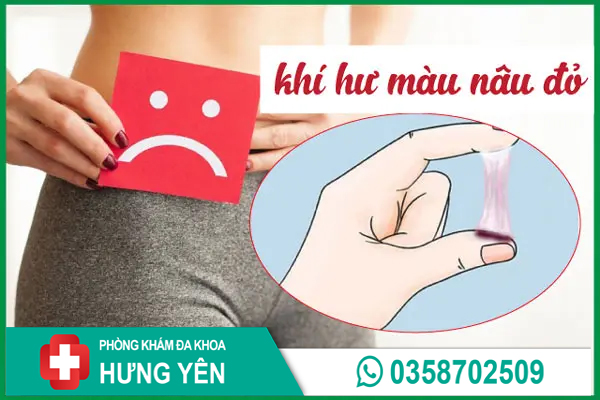 Dịch âm đạo màu nâu đỏ: Nguyên nhân, dấu hiệu, cách chữa và địa chỉ khám chữa bệnh