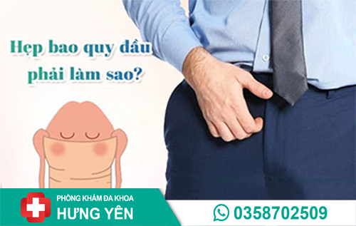 Hẹp bao quy đầu phải làm sao? – Giải pháp an toàn và hiệu quả