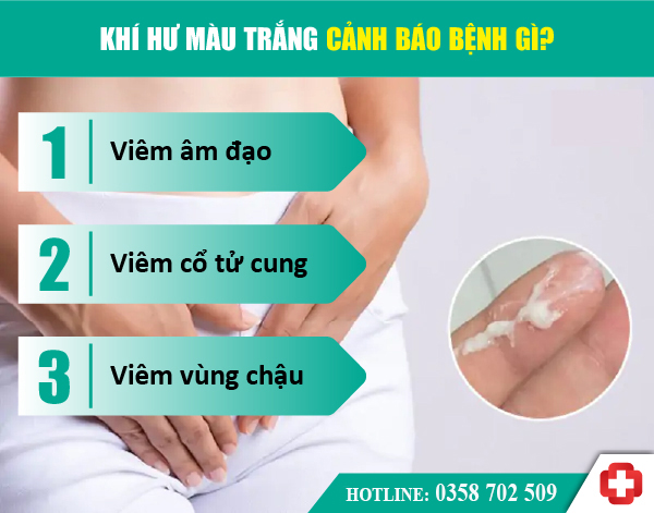 Khí hư màu trắng đục như bã đậu: 5 nguyên nhân bệnh lý & cách chữa trị