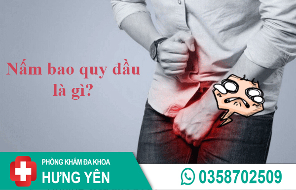 Bệnh nấm bao quy đầu 