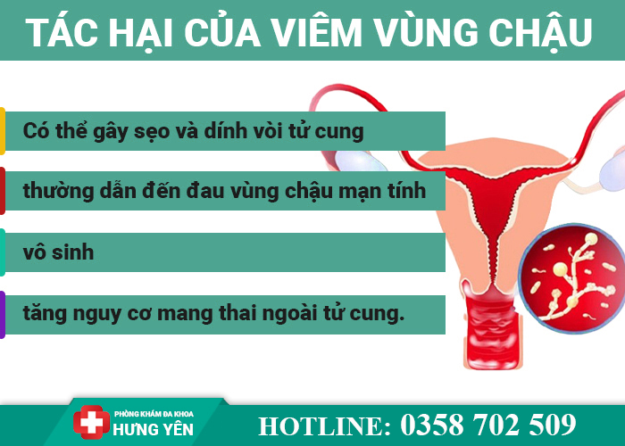 Tác hại của viêm vùng chậu