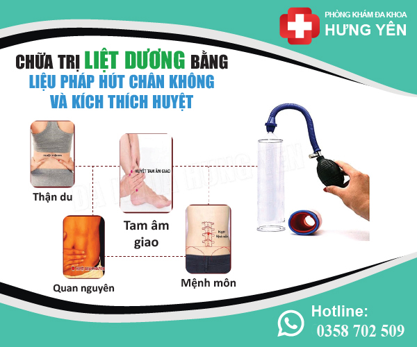 điều trị các biểu hiện của liệt dương hiệu quả