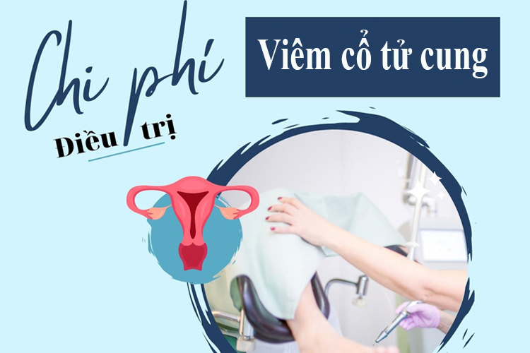 Chi phí điều trị viêm cổ tử cung