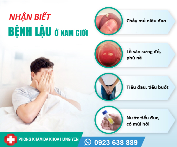 Biểu Hiện Bệnh Lậu Ở Nam Giới