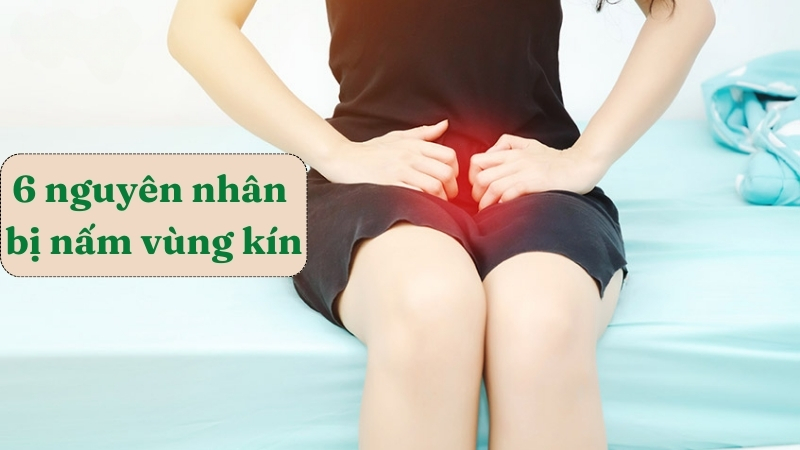 Nguyên nhân nấm vùng kín: Tìm hiểu nguyên nhân và cách phòng tránh