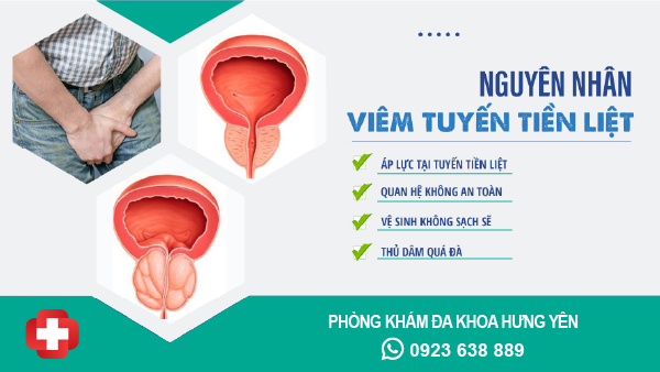 Nguyên nhân gây viêm tuyến tiền liệt: Hiểu rõ để điều trị hiệu quả