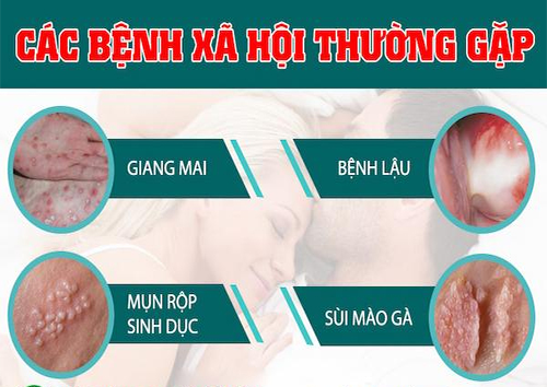 Các bệnh xã hội thường gặp