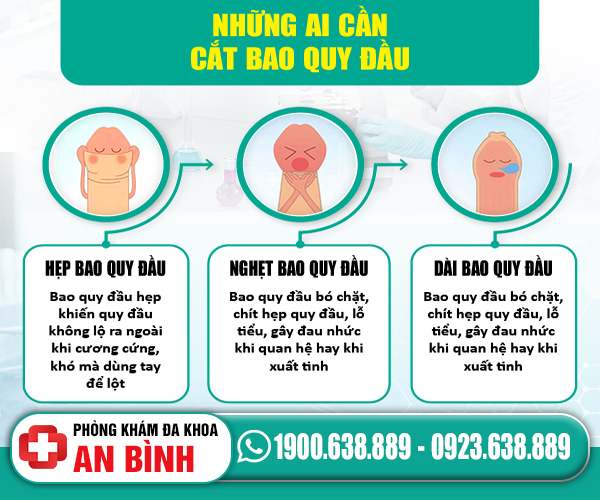 Khi nào nên cắt bao quy đầu